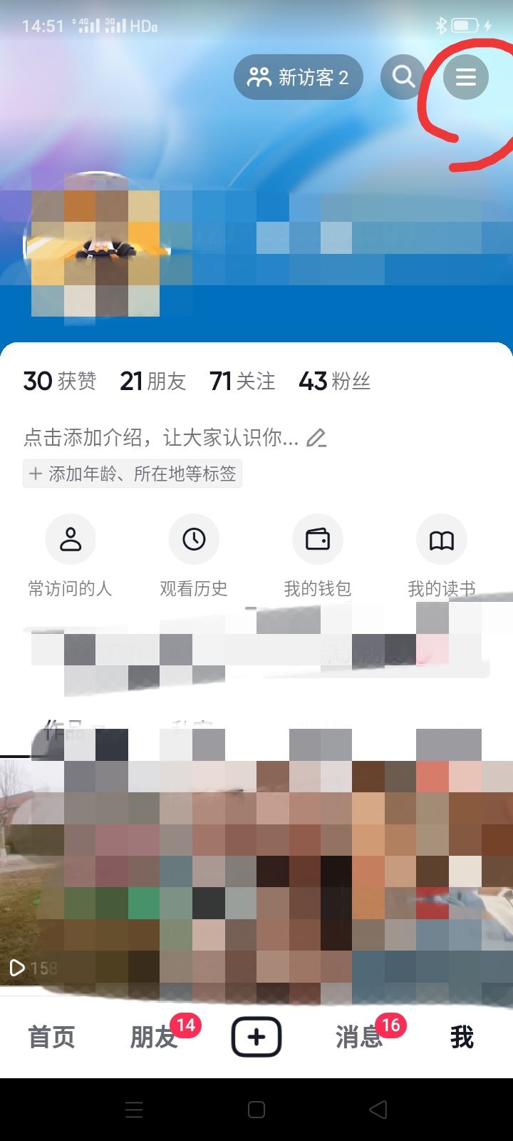 抖音?？吹娜嗽趺搓P掉關注提示？